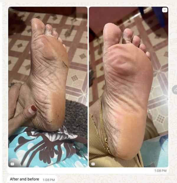 WhatsApp · After & before
