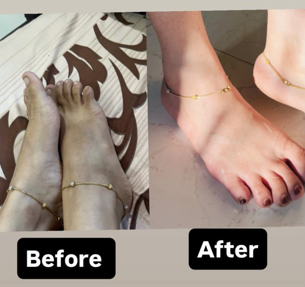 Before & after