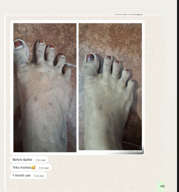 WhatsApp · 1 month of use